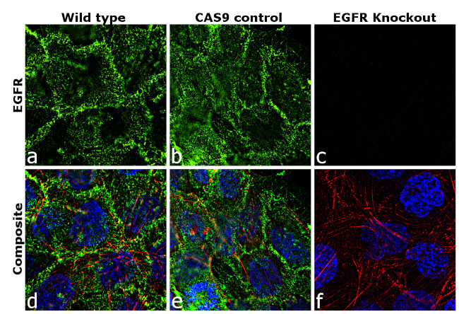 EGFR Antibody in Immunocytochemistry (ICC/IF)