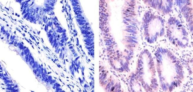 p53 Antibody in Immunohistochemistry (Paraffin) (IHC (P))