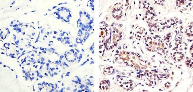 Ki-67 Antibody in Immunohistochemistry (Paraffin) (IHC (P))