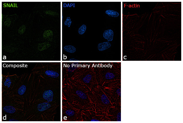 SNAIL Antibody in Immunocytochemistry (ICC/IF)