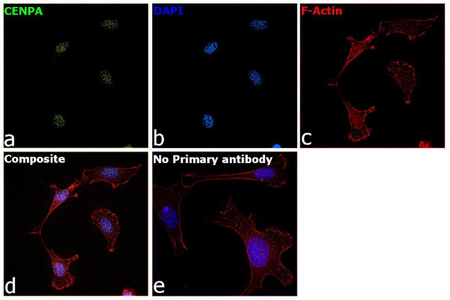 CENPA Antibody in Immunocytochemistry (ICC/IF)