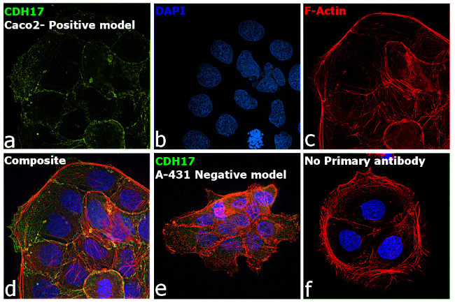 CDH17 Antibody