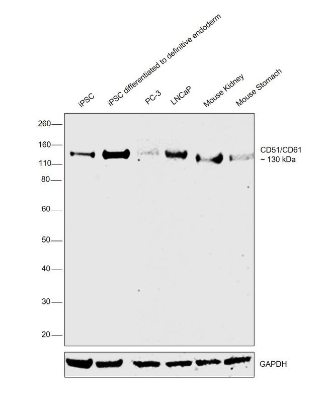 CD51 Antibody in Western Blot (WB)