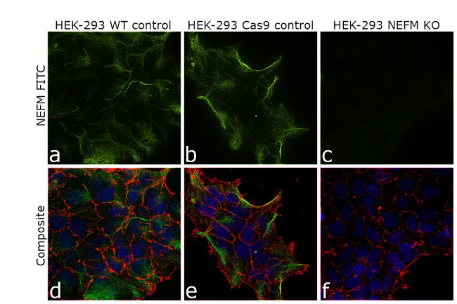 NEFM Antibody in Immunocytochemistry (ICC/IF)