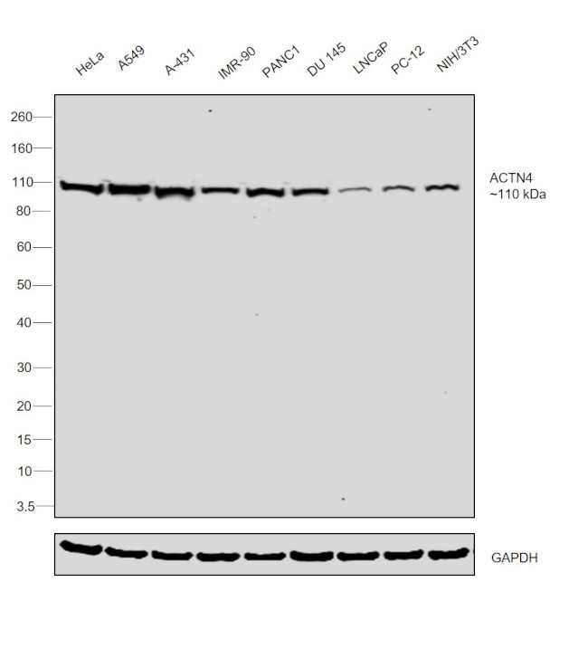 alpha Actinin 4 Antibody