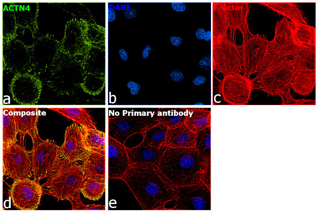 alpha Actinin 4 Antibody in Immunocytochemistry (ICC/IF)