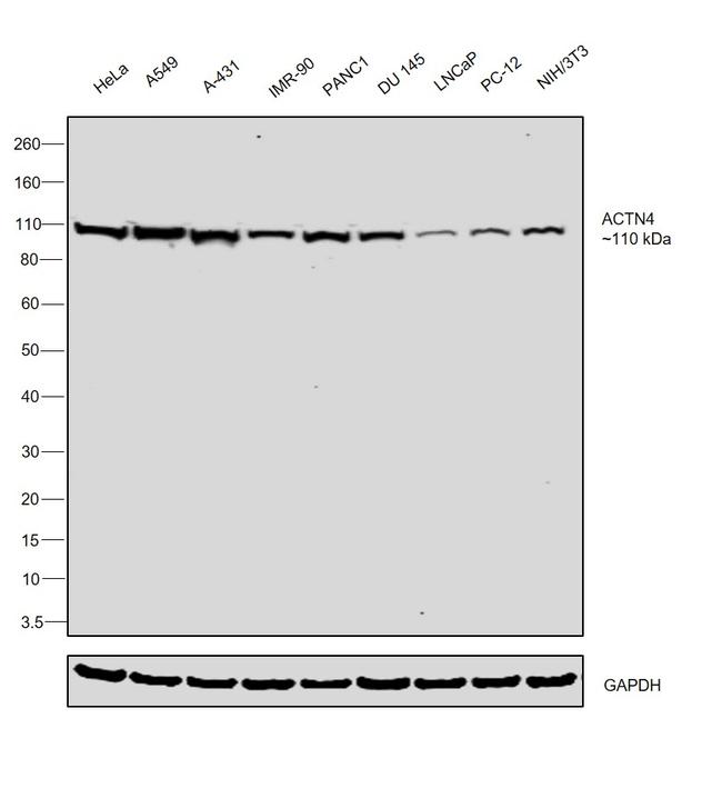 alpha Actinin 4 Antibody in Western Blot (WB)