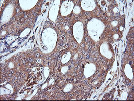 MAP2K1 Antibody in Immunohistochemistry (Paraffin) (IHC (P))