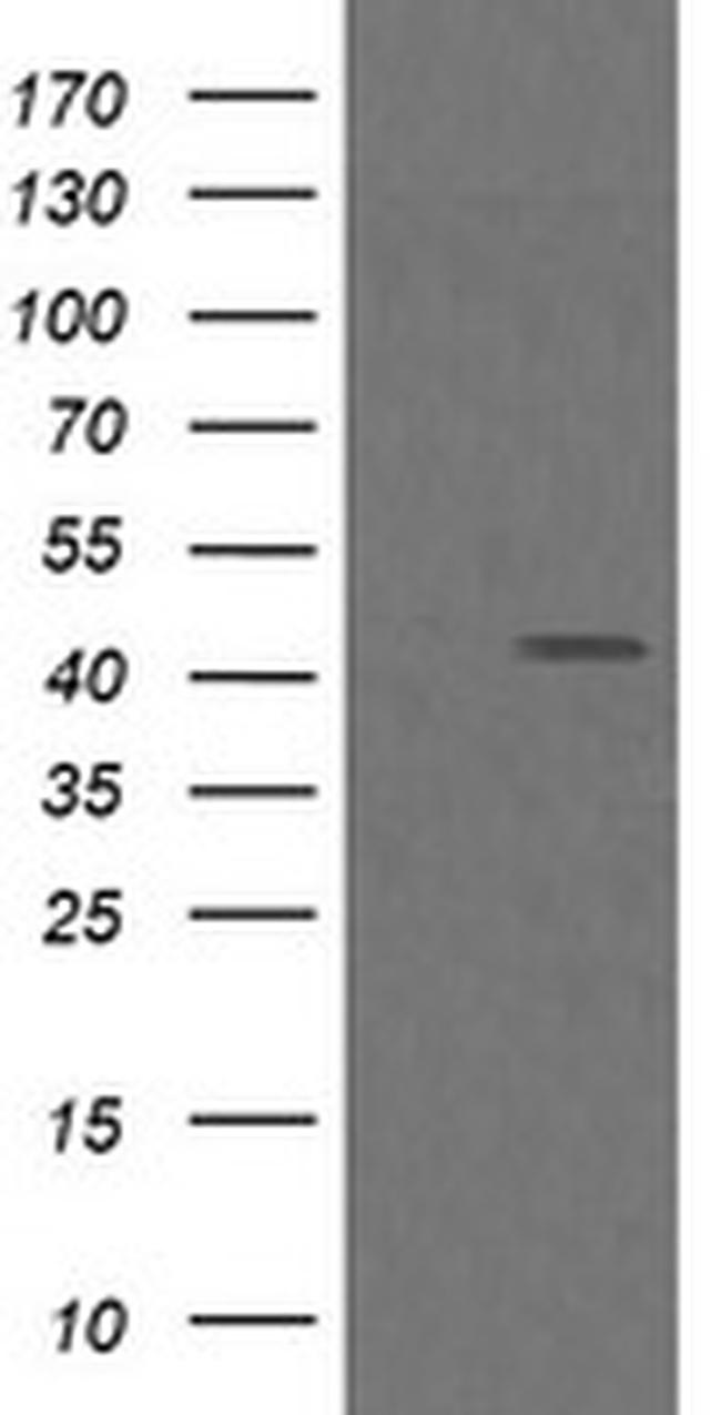 MAP2K1 Antibody in Western Blot (WB)