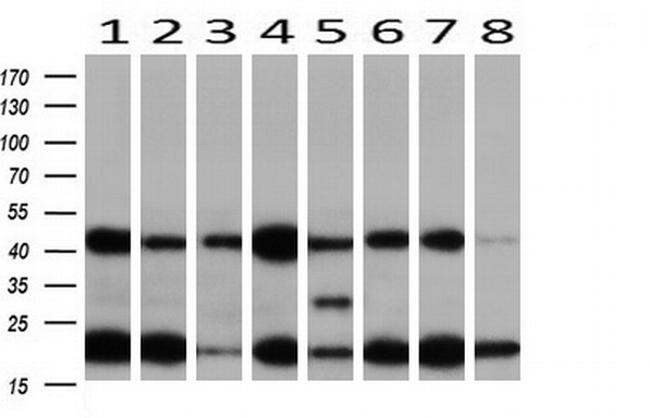 MAP2K1 Antibody in Western Blot (WB)