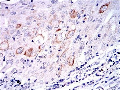 MEK7 Antibody in Immunohistochemistry (Paraffin) (IHC (P))