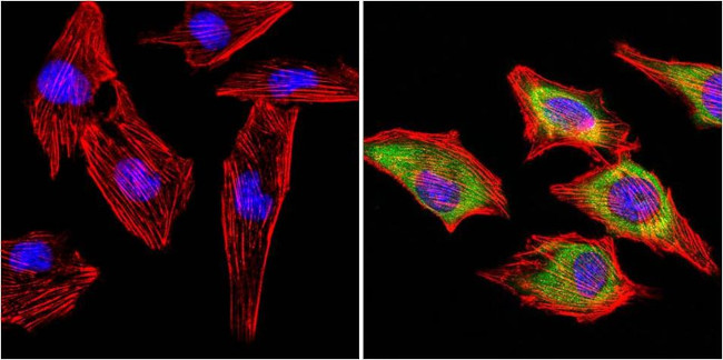 MUSK Antibody in Immunocytochemistry (ICC/IF)