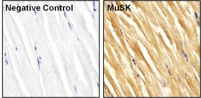 MUSK Antibody in Immunohistochemistry (Paraffin) (IHC (P))