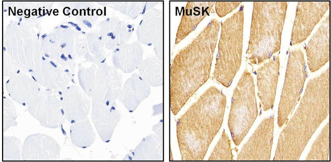 MUSK Antibody in Immunohistochemistry (Paraffin) (IHC (P))