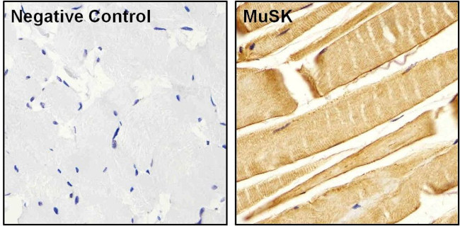 MUSK Antibody in Immunohistochemistry (Paraffin) (IHC (P))