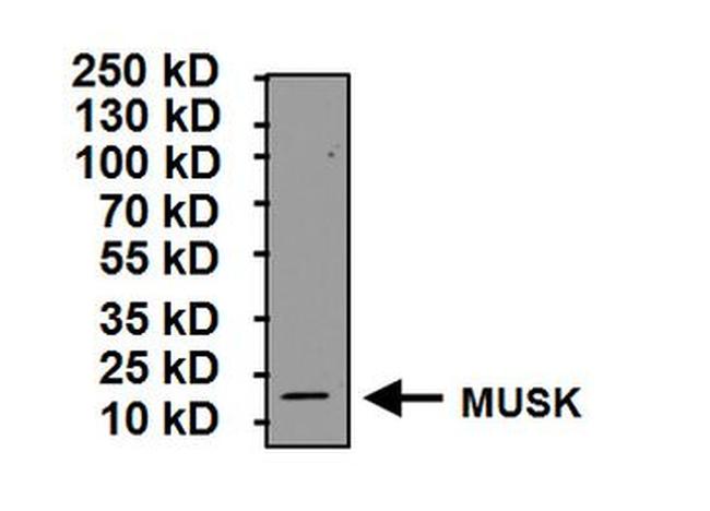 MUSK Antibody in Western Blot (WB)