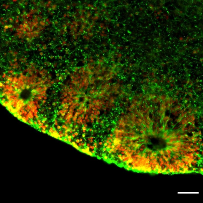 Mouse IgG (H+L) Secondary Antibody in Immunohistochemistry (Frozen) (IHC (F))