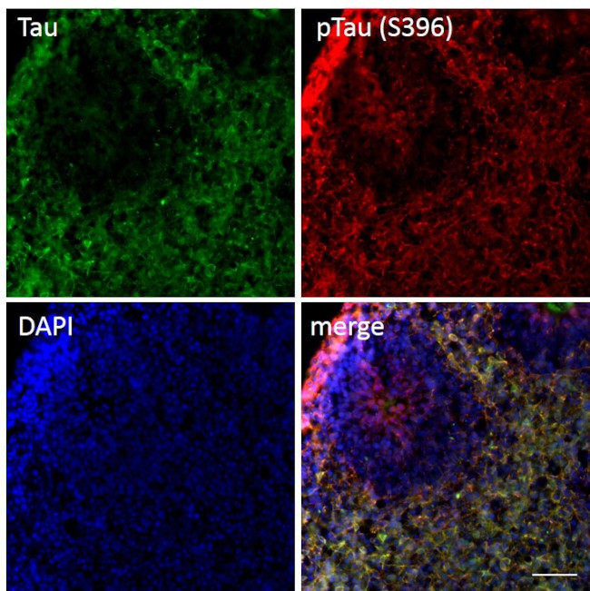 Mouse IgG (H+L) Secondary Antibody in Immunohistochemistry (Frozen) (IHC (F))