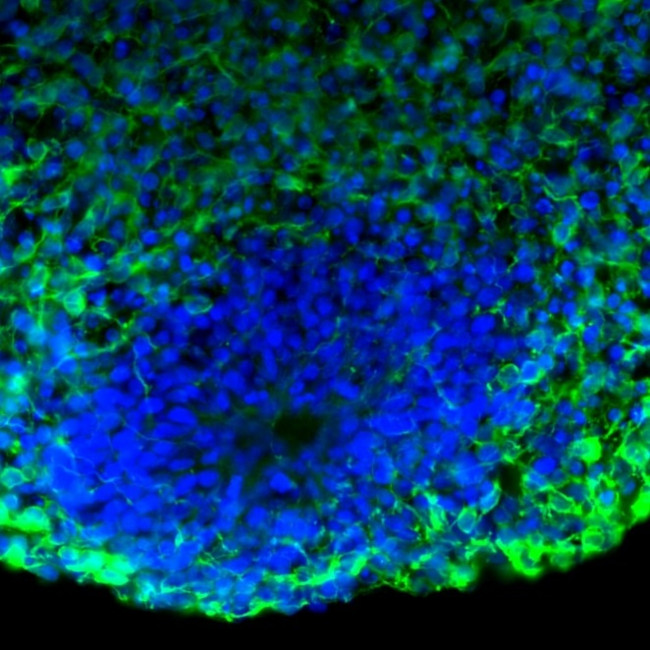 Mouse IgG (H+L) Secondary Antibody in Immunohistochemistry (Frozen) (IHC (F))