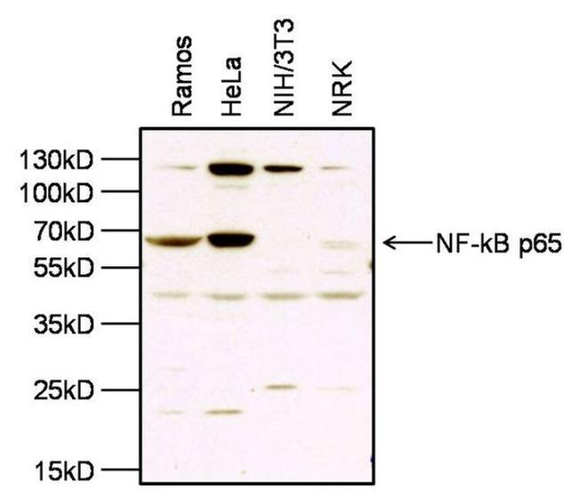 NFkB p65 Antibody in Western Blot (WB)