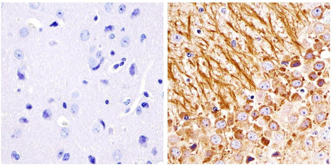 NEFM Antibody in Immunohistochemistry (Paraffin) (IHC (P))