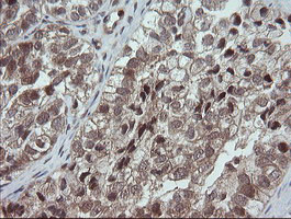 OTUB1 Antibody in Immunohistochemistry (Paraffin) (IHC (P))