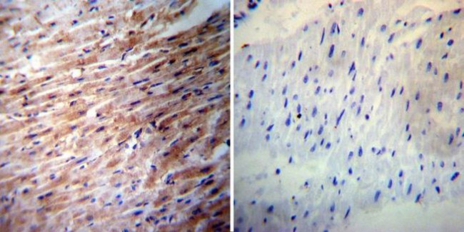 iNOS Antibody in Immunohistochemistry (Paraffin) (IHC (P))