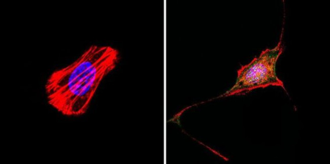 RAC1 Antibody in Immunocytochemistry (ICC/IF)