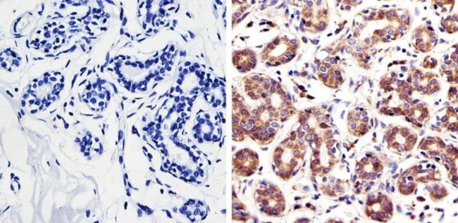 RAC1 Antibody in Immunohistochemistry (IHC)