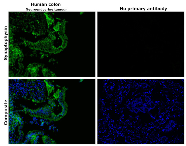 Synaptophysin Antibody in Immunohistochemistry (Paraffin) (IHC (P))