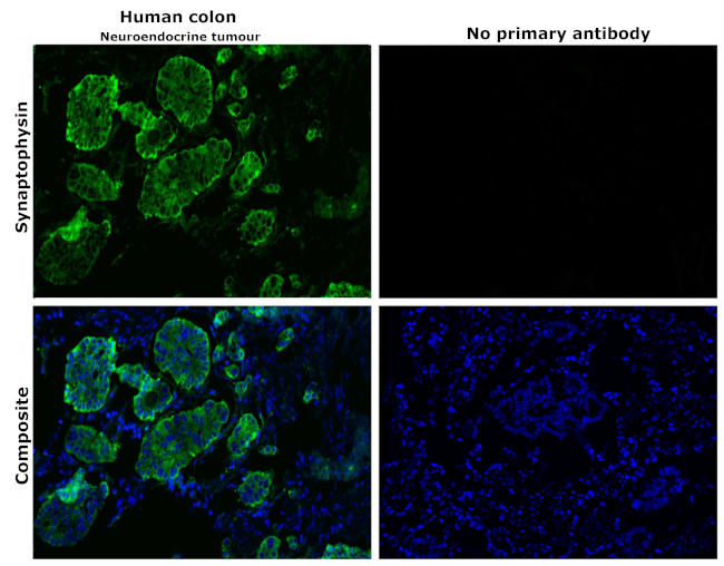 Synaptophysin Antibody in Immunohistochemistry (Paraffin) (IHC (P))