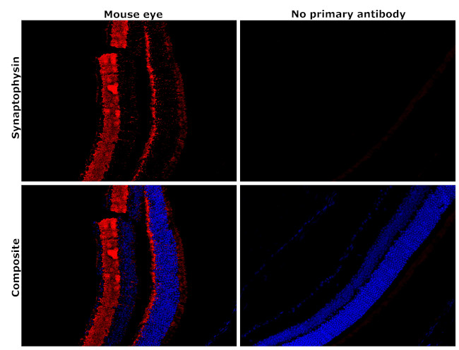 Synaptophysin Antibody in Immunohistochemistry (Paraffin) (IHC (P))