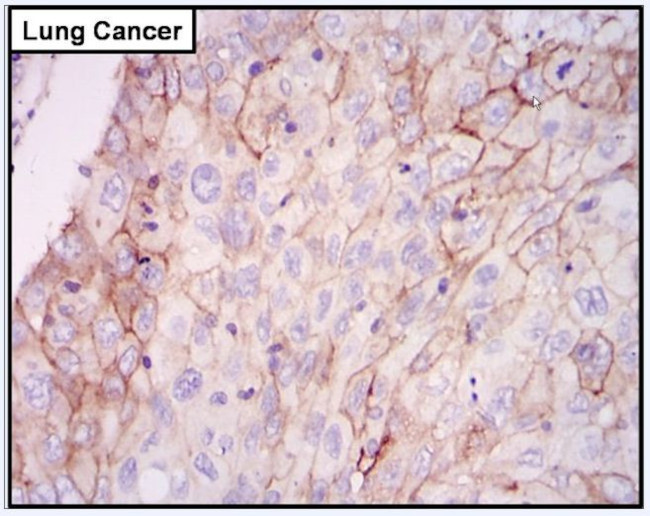 EGFR Antibody in Immunohistochemistry (Paraffin) (IHC (P))