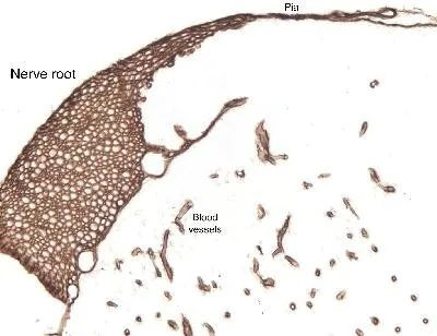 Laminin Antibody in Immunohistochemistry (Paraffin) (IHC (P))