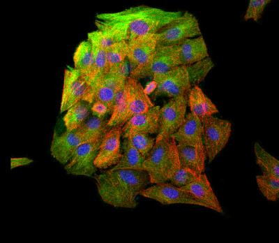 beta Tubulin Antibody in Immunocytochemistry (ICC/IF)