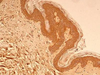 beta Tubulin Antibody in Immunohistochemistry (Paraffin) (IHC (P))