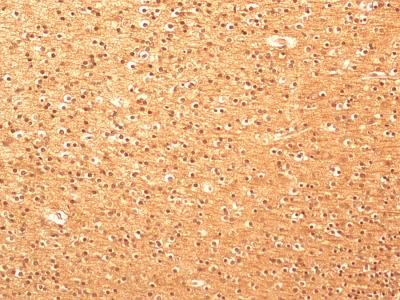 beta Tubulin Antibody in Immunohistochemistry (Paraffin) (IHC (P))