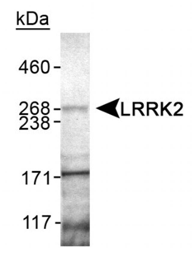 LRRK2 Antibody in Western Blot (WB)