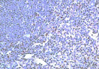 TLR2 Antibody in Immunohistochemistry (IHC)