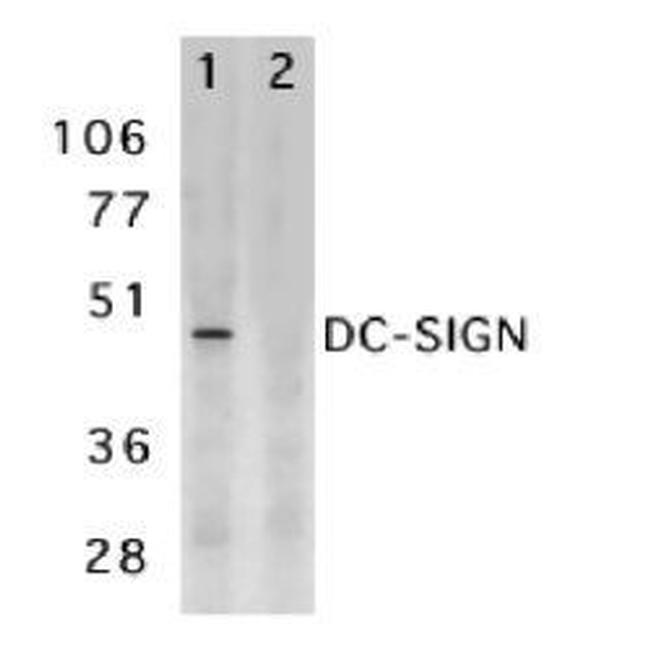 DC-SIGN Antibody in Western Blot (WB)