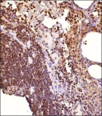 STAT1 Antibody in Immunohistochemistry (Paraffin) (IHC (P))