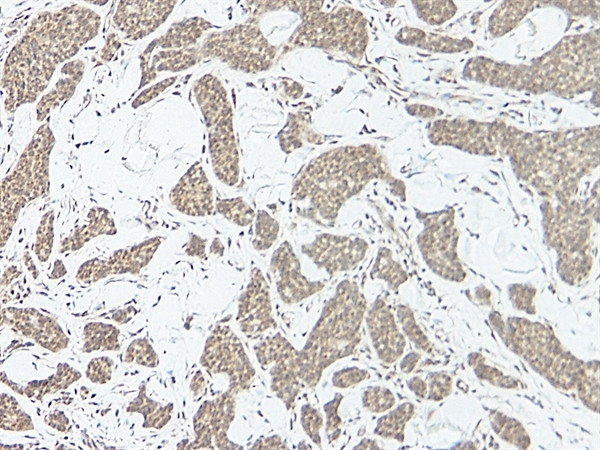 IL-17A Antibody in Immunohistochemistry (Paraffin) (IHC (P))