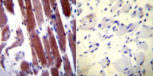 Parvalbumin Antibody in Immunohistochemistry (Paraffin) (IHC (P))