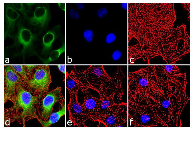 Phospho-HSP27 (Ser15) Antibody in Immunocytochemistry (ICC/IF)