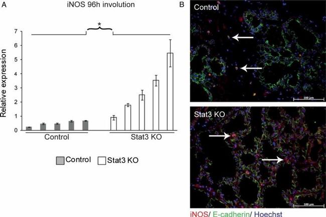 iNOS Antibody in Immunohistochemistry (IHC)