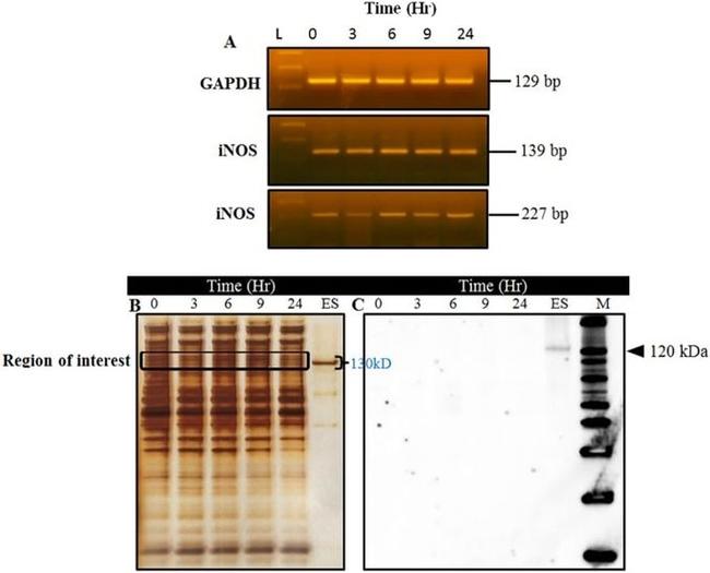 iNOS Antibody in Western Blot (WB)