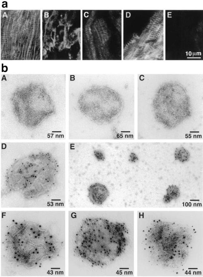 iNOS Antibody in Immunomicroscopy (IM)