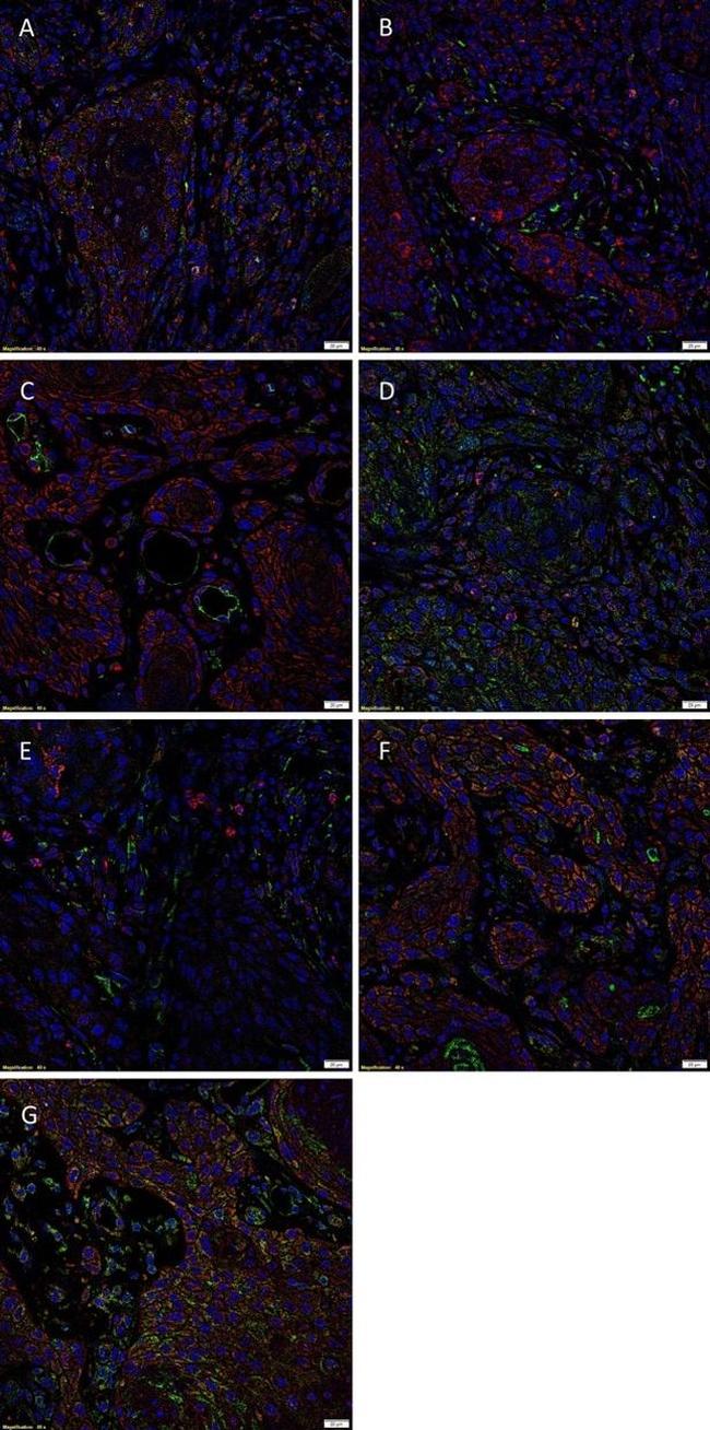 SOX2 Antibody in Immunohistochemistry (IHC)