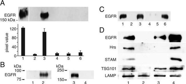 EGFR Antibody in Western Blot (WB)