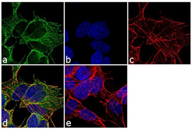 beta Tubulin Antibody in Immunocytochemistry (ICC/IF)